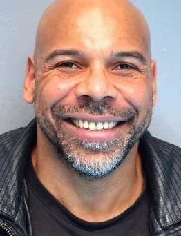 Patrick Kodjo Topou