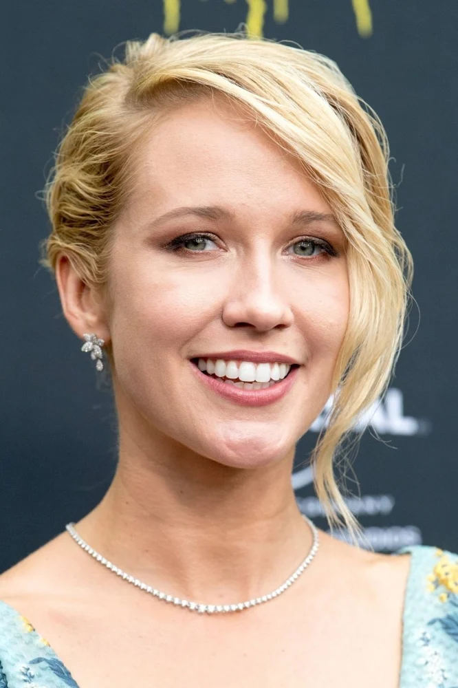 Anna Camp