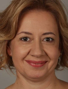 Özlem Çakar